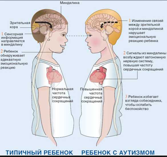 Атипичный