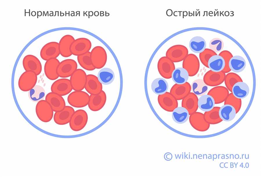 Ограничения