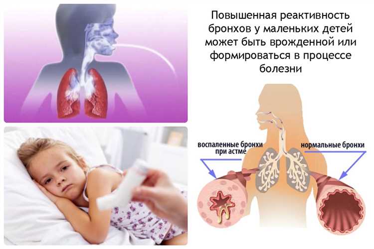 Причины