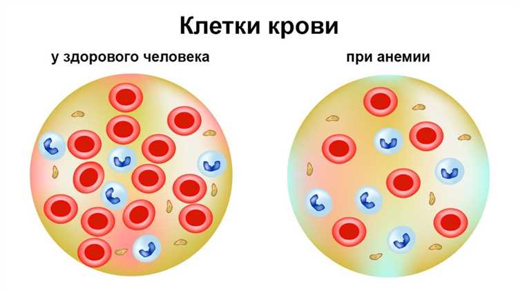Профилактика