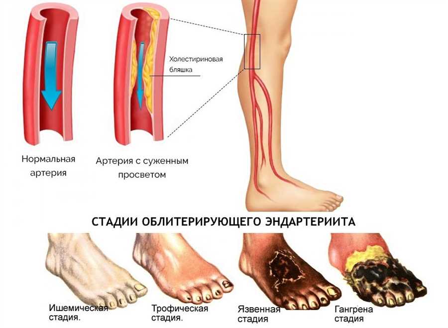 Факторы