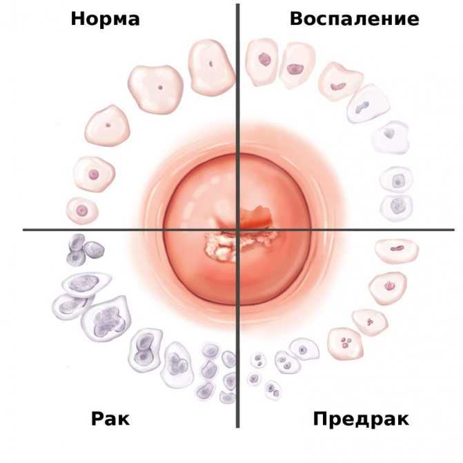 Предупреждение