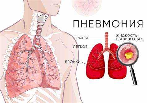 Профилактика