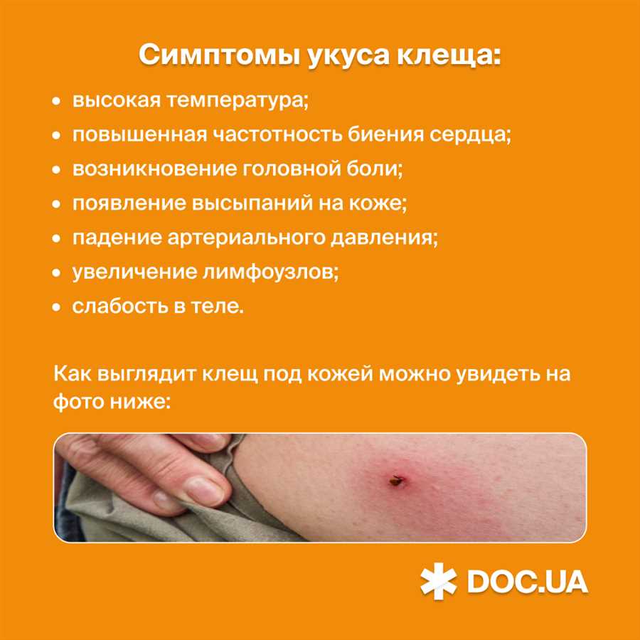 Способы