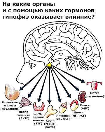 Синдром