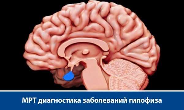 Сахарный