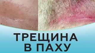 Гормональный